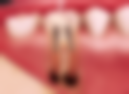 上海银屏口腔患者真实口碑