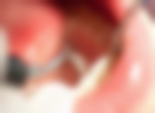 山东临沂沂水沂城口腔门诊部来院指引