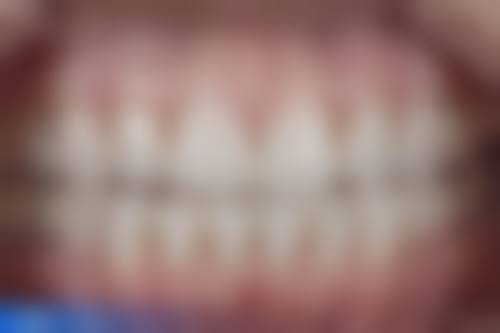 北京雅医家（海鲸海豚）口腔特色诊疗技术