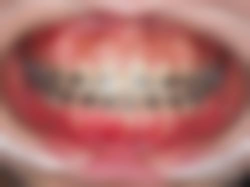 广州麦特登口腔(凤凰城店)全品类专科服务