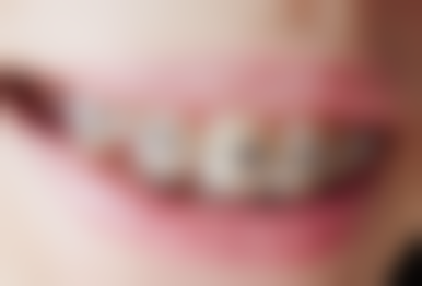 沧州爱齿口腔诊疗项目与收费标准