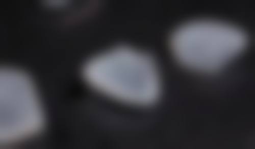 陕西西安泰康拜博口腔的特色技术