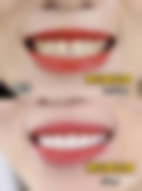 宁乡玉齿口腔特色诊疗技术