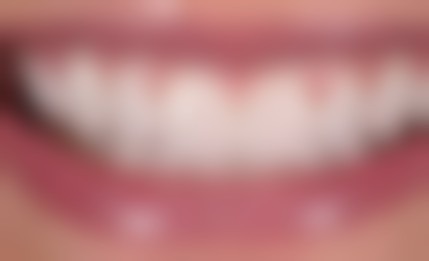 湖北咸宁赤壁德仁口腔来院指南与预约方式