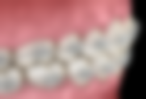 重庆开州严永均口腔特色诊疗技术解析