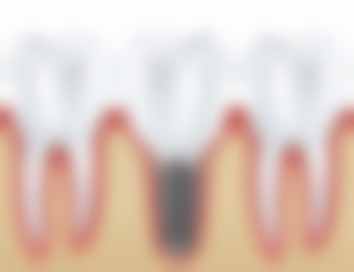 天水贝洁口腔诊所特色诊疗技术