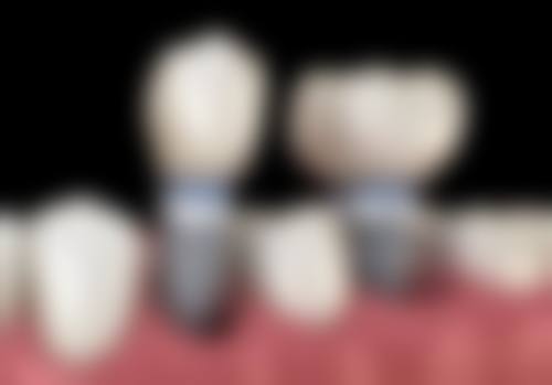 河南郑州康固口腔医院诊疗设备与硬件实力