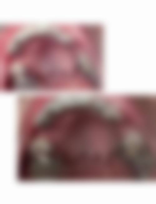 爱顿口腔（三水总院）患者真实口碑评价