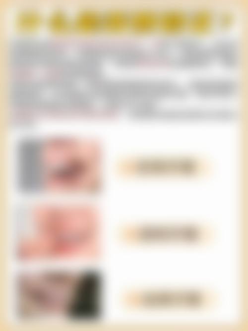 杨素的临床实战与个性化诊疗