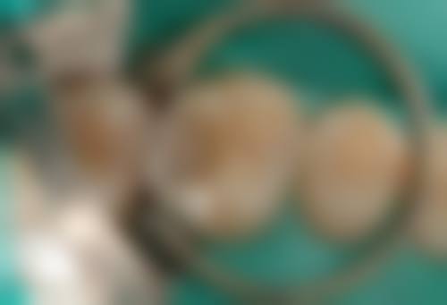 南京玖佰口腔诊所患者真实口碑