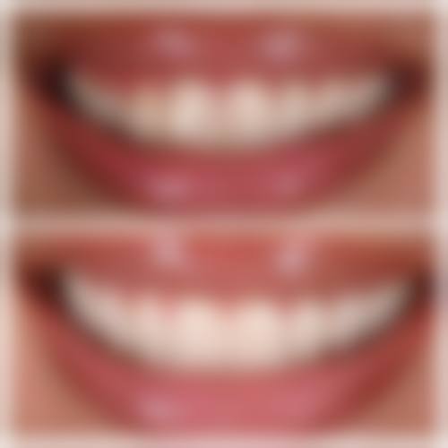 张海余的临床实战与个性化方案