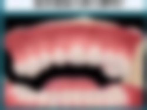 齐齐哈尔众尚益博口腔门诊部特色诊疗技术