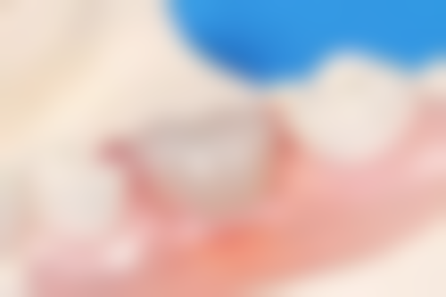 中山精美口腔精良诊疗设备保护