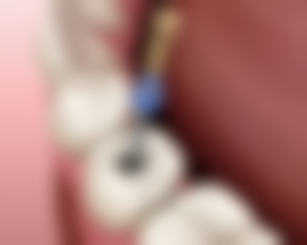 江门蓬江齿美口腔门诊部透明化收费标准