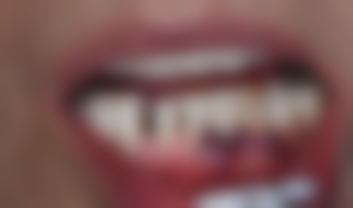 江西鹰潭谭小英牙科来院指引与就诊须知