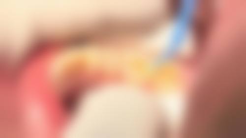 徐欢欢的临床实战与个性化诊疗