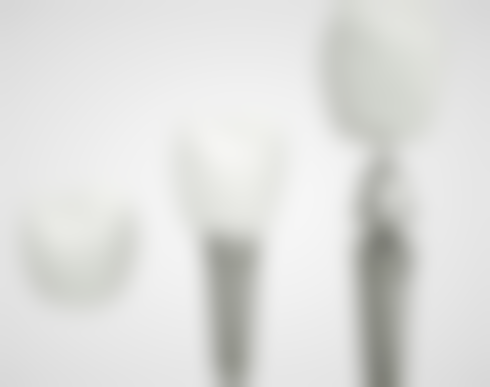 江西鹰潭谭小英牙科特色诊疗技术