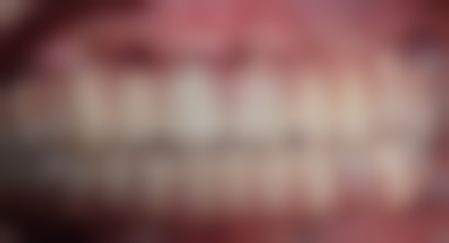 陕西汉中勉县董金枝口腔诊所收费标准与价格透明