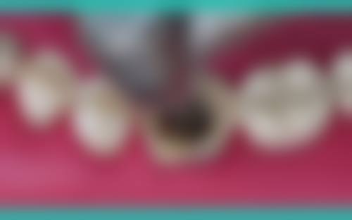 陕西汉中勉县董金枝口腔诊所医生团队实力