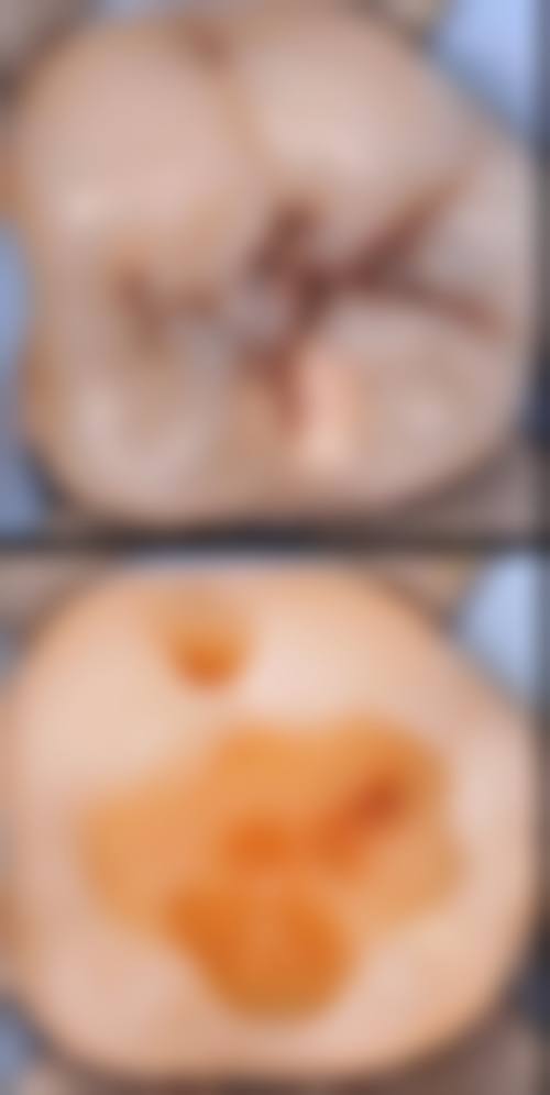 陕西汉中勉县董金枝口腔诊所特色诊疗技术