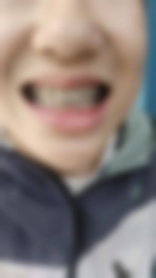 昆明市口腔医院口腔正畸科特色诊疗技术