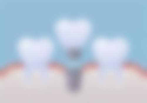 广东东莞塘厦圣明口腔收费标准