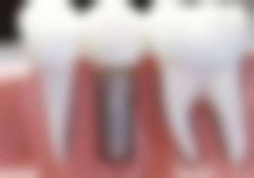 舟山一天口腔来院指引