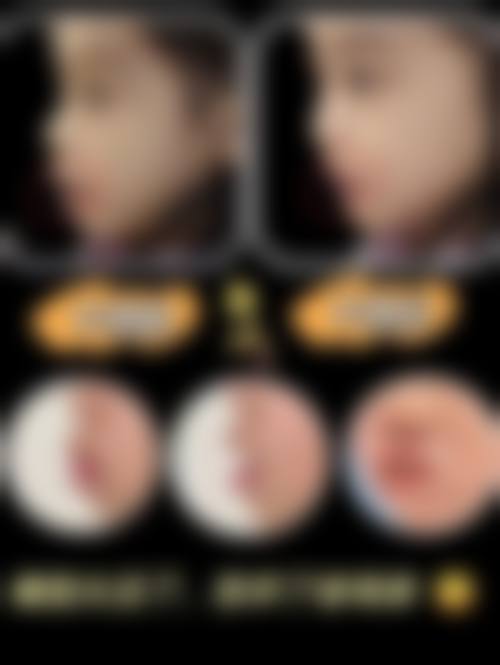 昆山晶美口腔诊所收费价格参考