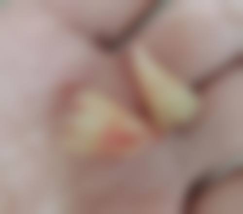 富阳银湖口腔(高桥万达广场)收费标准参考