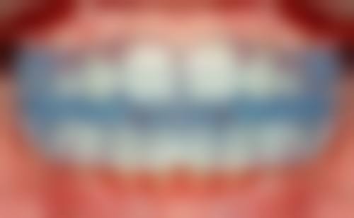 佛山三水乐平周杰口腔诊所特色诊疗技术