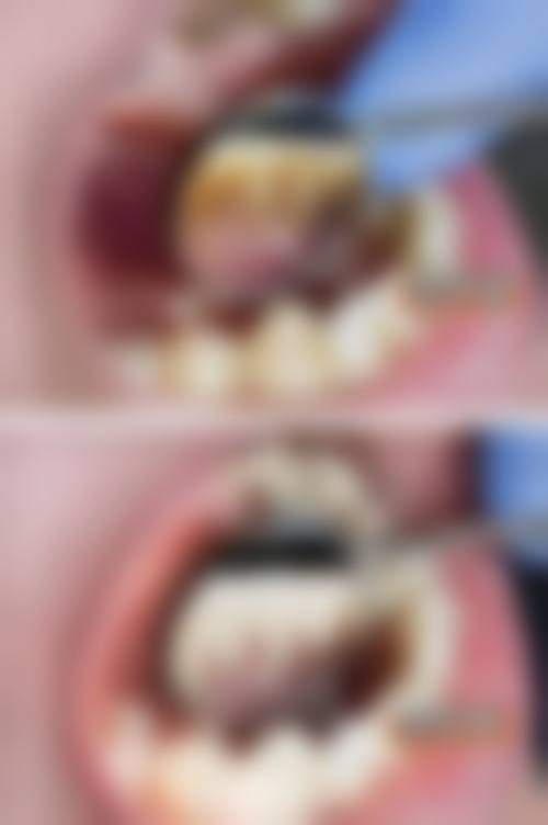 西安未央区台一口腔门诊部收费标准与支付方式