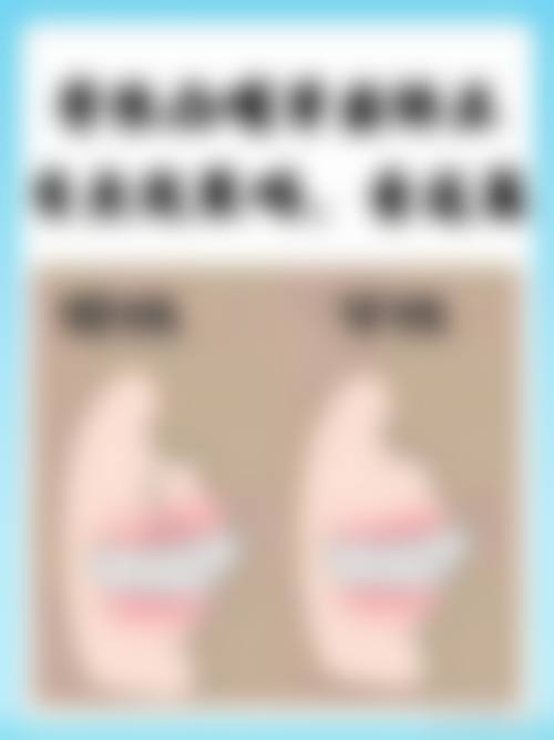 江苏苏州昆山王波口腔收费价格标准