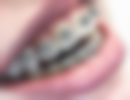 重庆康悦美口腔李家沱店就诊环境与服务优势