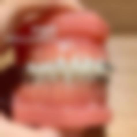 广东广州英特拉口腔收费价格说明