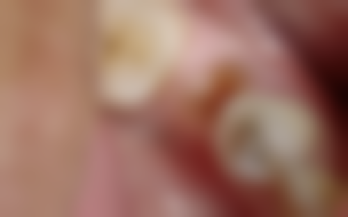 昆山鲸华口腔来院指引