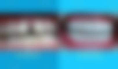 陈容花医生的价格参考与就诊指引