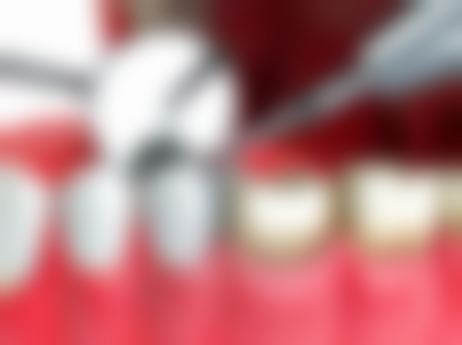 吴然熊的价格参考与就诊指引