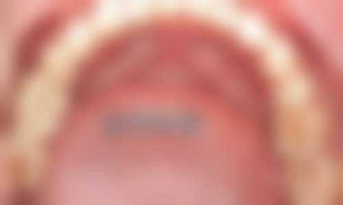 海口鼎点口腔(东湖分院)收费参考标准