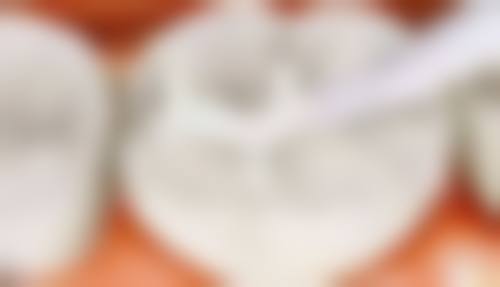 南京值德口腔门诊部特色诊疗技术