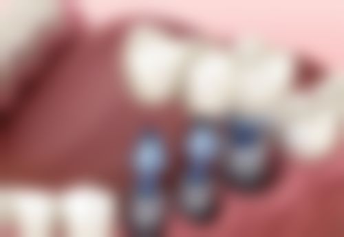 上海鼎植口腔(人民广场店)患者真实反馈