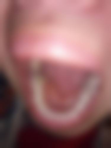 张俊阳的收费标准与就诊指引