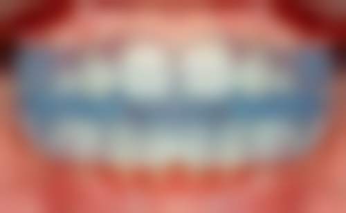 湖北荆州王婷婷口腔医生团队实力