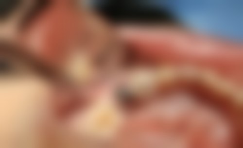 山东德州陵城典雅口腔来院指引