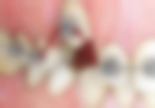 湖北荆州王婷婷口腔来院指引