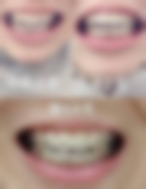 张俊阳的临床实战与个性化方案