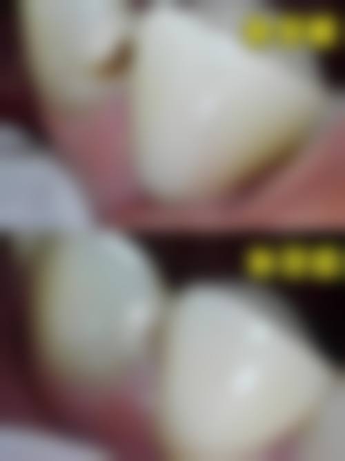 泰安优嘉口腔诊所特色诊疗技术