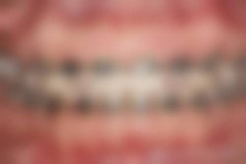 深圳拜尔斯口腔诊所诊疗收费标准说明