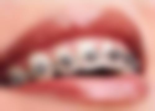 深圳拜尔斯口腔诊所特色诊疗技术项目