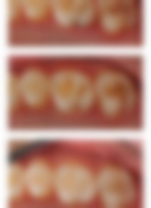 王琪的临床实战与个性化诊疗