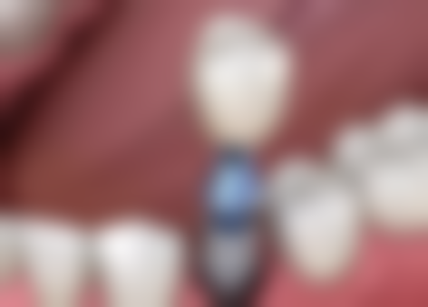 梧州长洲区冬文口腔来院指引